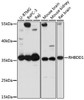 Cell Death Antibodies 1 Anti-RHBDD1 Antibody CAB14350