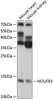 Cell Biology Antibodies 4 Anti-NDUFB3 Antibody CAB14378