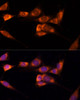 Signal Transduction Antibodies 1 Anti-TXNDC12 Antibody CAB14403