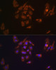 Cell Biology Antibodies 5 Anti-TRH Antibody CAB14472