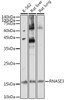 Cell Biology Antibodies 5 Anti-RNASE3 Antibody CAB14489