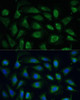 Cell Biology Antibodies 5 Anti-SPARC Antibody CAB14494