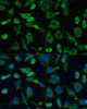 Cell Biology Antibodies 5 Anti-SPARC Antibody CAB14494