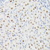 Cell Death Antibodies 1 Anti-DYNLL1 Antibody CAB14496
