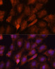 Cell Biology Antibodies 5 Anti-SMYD3 Antibody CAB14516