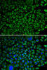 Cardiovascular Antibodies Anti-F10 Antibody CAB1452