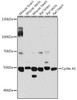Cell Cycle Antibodies 1 Anti-Cyclin A1 Antibody CAB14529