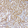 Metabolism Antibodies 1 Anti-DLAT Antibody CAB14530