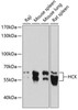 Cell Biology Antibodies 5 Anti-HCK Antibody CAB14537