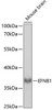 Developmental Biology Anti-EFNB1 Antibody CAB14562