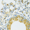Signal Transduction Antibodies 1 Anti-SLC37A4 Antibody CAB14564