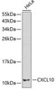Cell Biology Antibodies 5 Anti-CXCL10 Antibody CAB1457