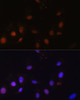 Immunology Antibodies 1 Anti-SNW1 Antibody CAB14580