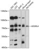 Signal Transduction Antibodies 1 Anti-ADGRL4 Antibody CAB14595