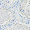 Signal Transduction Antibodies 1 Anti-SLC2A9 Antibody CAB14606