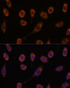 Signal Transduction Antibodies 1 Anti-CCT6B Antibody CAB14615