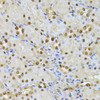 Cell Biology Antibodies 5 Anti-RPS27A Antibody CAB14618