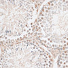 Cell Biology Antibodies 5 Anti-HMGN1 Antibody CAB14646
