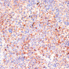 Immunology Antibodies 1 Anti-IL-4R Antibody CAB14648