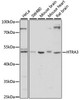 Cell Biology Antibodies 5 Anti-HTRA3 Antibody CAB14649