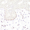 Developmental Biology Anti-GLI1 Antibody CAB14675