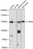 Cell Biology Antibodies 5 Anti-IPO8 Antibody CAB14679