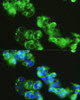 Cell Biology Antibodies 5 Anti-GOLGA1 Antibody CAB14688