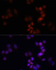 Cell Biology Antibodies 16 Anti-KDM7A Antibody CAB14692