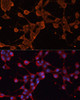 Signal Transduction Antibodies 1 Anti-ABCB11 Antibody CAB14694