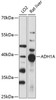 Cell Biology Antibodies 5 Anti-ADH1A Antibody CAB14701