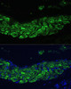 Metabolism Antibodies 1 Anti-ALOX12 Antibody CAB14703