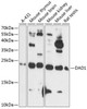 Cell Death Antibodies 1 Anti-DAD1 Antibody CAB14723