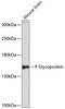 Signal Transduction Antibodies 1 Anti-P Glycoprotein Antibody CAB14765