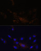 Immunology Antibodies 1 Anti-PSMB7 Antibody CAB14771