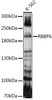 Epigenetics and Nuclear Signaling Antibodies 2 Anti-RBBP6 Antibody CAB14776