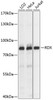 Cell Biology Antibodies 5 Anti-RDX Antibody CAB14777