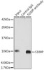 Signal Transduction Antibodies 1 Anti-S100P Antibody CAB14780