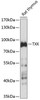 Immunology Antibodies 1 Anti-TXK Antibody CAB14792