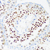Immunology Antibodies 1 Anti-DDX21 Antibody CAB14820