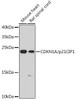 Cell Cycle Antibodies 1 Anti-CDKN1A/p21CIP1 Antibody CAB1483