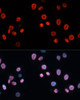 Cell Cycle Antibodies 1 Anti-CDKN1A/p21CIP1 Antibody CAB1483