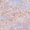 Immunology Antibodies 1 Anti-G3BP1 Antibody CAB14836