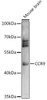 Immunology Antibodies 1 Anti-CCR9 Antibody CAB14848