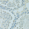 Immunology Antibodies 1 Anti-PSIP1 Antibody CAB14852