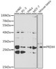 KO Validated Antibodies 1 Anti-PRDX4 Antibody CAB1486KO Validated