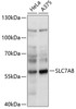 Signal Transduction Antibodies 2 Anti-SLC7A8 Antibody CAB14861