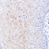 Epigenetics and Nuclear Signaling Antibodies 2 Anti-Polyclonal AntibodyPC1 Antibody CAB14872