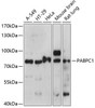 Epigenetics and Nuclear Signaling Antibodies 2 Anti-Polyclonal AntibodyPC1 Antibody CAB14872