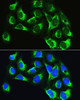 Metabolism Antibodies 1 Anti-LARS Antibody CAB14890