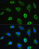 Metabolism Antibodies 1 Anti-LARS Antibody CAB14890